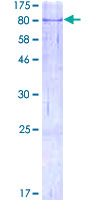 AIFM1 / AIF / PDCD8 Protein - 12.5% SDS-PAGE of human AIFM1 stained with Coomassie Blue