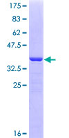 AIFM1 / AIF / PDCD8 Protein - 12.5% SDS-PAGE Stained with Coomassie Blue.