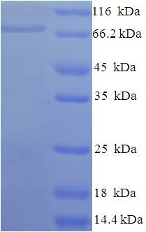 AIFM1 / AIF / PDCD8 Protein