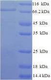 AIFM1 / AIF / PDCD8 Protein