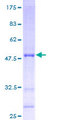 AIG1 Protein - 12.5% SDS-PAGE of human AIG1 stained with Coomassie Blue