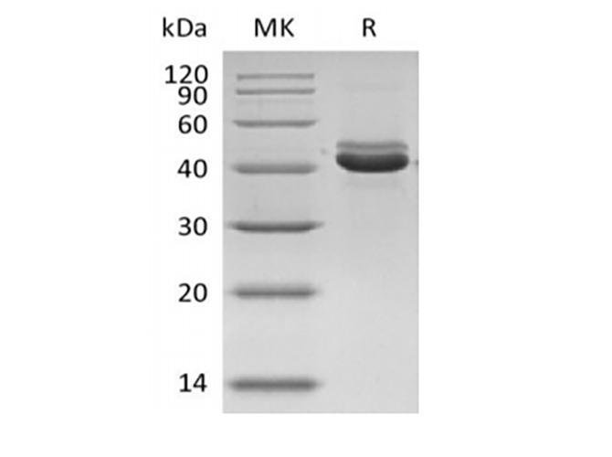 AIM / CD5L Protein - Recombinant Human CD5 Antigen-Like/CD5L/Sp alpha/AIM (C-6His)