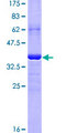 AIM / CD5L Protein - 12.5% SDS-PAGE Stained with Coomassie Blue.