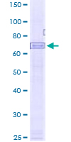 AIM2 Protein - 12.5% SDS-PAGE of human AIM2 stained with Coomassie Blue