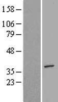 AIMP2 Protein - Western validation with an anti-DDK antibody * L: Control HEK293 lysate R: Over-expression lysate