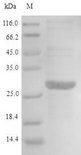 AIMP2 Protein - (Tris-Glycine gel) Discontinuous SDS-PAGE (reduced) with 5% enrichment gel and 15% separation gel.
