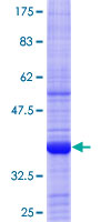AIPL1 Protein - 12.5% SDS-PAGE Stained with Coomassie Blue.