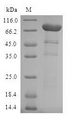 AIPL1 Protein - (Tris-Glycine gel) Discontinuous SDS-PAGE (reduced) with 5% enrichment gel and 15% separation gel.