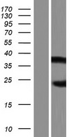 AIRE Protein - Western validation with an anti-DDK antibody * L: Control HEK293 lysate R: Over-expression lysate