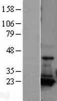 AK1 / Adenylate Kinase 1 Protein - Western validation with an anti-DDK antibody * L: Control HEK293 lysate R: Over-expression lysate