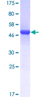 AK1 / Adenylate Kinase 1 Protein - 12.5% SDS-PAGE of human AK1 stained with Coomassie Blue