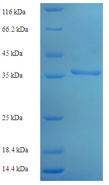 AK1 / Adenylate Kinase 1 Protein