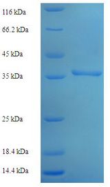 AK1 / Adenylate Kinase 1 Protein