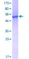 AK2 / Adenylate Kinase 2 Protein - 12.5% SDS-PAGE of human AK2 stained with Coomassie Blue
