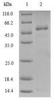 AK2 / Adenylate Kinase 2 Protein - (Tris-Glycine gel) Discontinuous SDS-PAGE (reduced) with 5% enrichment gel and 15% separation gel.