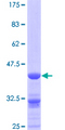 AK2 / Adenylate Kinase 2 Protein - 12.5% SDS-PAGE Stained with Coomassie Blue.