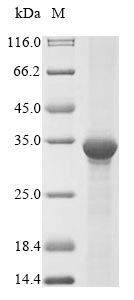 AK3 / Adenylate Kinase 3 Protein - (Tris-Glycine gel) Discontinuous SDS-PAGE (reduced) with 5% enrichment gel and 15% separation gel.