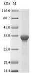 AK3 / Adenylate Kinase 3 Protein - (Tris-Glycine gel) Discontinuous SDS-PAGE (reduced) with 5% enrichment gel and 15% separation gel.