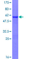 AK3 / Adenylate Kinase 3 Protein - 12.5% SDS-PAGE of human AK3 stained with Coomassie Blue