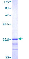 AK3 / Adenylate Kinase 3 Protein - 12.5% SDS-PAGE Stained with Coomassie Blue.