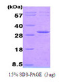 AK3 / Adenylate Kinase 3 Protein