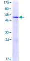 AK4 / Adenylate Kinase 4 Protein - 12.5% SDS-PAGE of human AK3L1 stained with Coomassie Blue