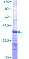 AK4 / Adenylate Kinase 4 Protein - 12.5% SDS-PAGE Stained with Coomassie Blue.