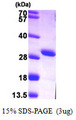 AK4 / Adenylate Kinase 4 Protein