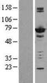 AK5 / Adenylate Kinase 5 Protein - Western validation with an anti-DDK antibody * L: Control HEK293 lysate R: Over-expression lysate