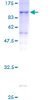 AK5 / Adenylate Kinase 5 Protein - 12.5% SDS-PAGE of human AK5 stained with Coomassie Blue