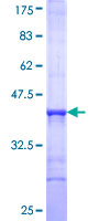 AK5 / Adenylate Kinase 5 Protein - 12.5% SDS-PAGE Stained with Coomassie Blue.