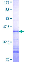 AK7 / Adenylate Kinase 7 Protein - 12.5% SDS-PAGE Stained with Coomassie Blue.