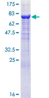 AK8 Protein - 12.5% SDS-PAGE of human C9orf98 stained with Coomassie Blue