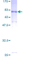 AK9 / AKD1 / AKD2 Protein - 12.5% SDS-PAGE of human C6orf199 stained with Coomassie Blue