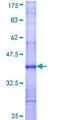 AK9 / AKD1 / AKD2 Protein - 12.5% SDS-PAGE Stained with Coomassie Blue