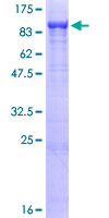 AKAP10 Protein - 12.5% SDS-PAGE of human AKAP10 stained with Coomassie Blue