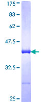 AKAP11 / KIAA0629 Protein - 12.5% SDS-PAGE Stained with Coomassie Blue.