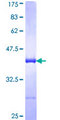 AKAP11 / KIAA0629 Protein - 12.5% SDS-PAGE Stained with Coomassie Blue.