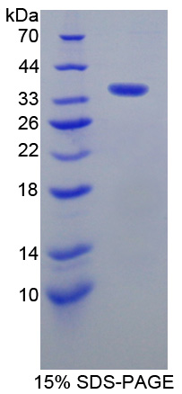 AKAP11 / KIAA0629 Protein - Recombinant  A Kinase Anchor Protein 11 By SDS-PAGE