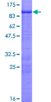 AKAP5 / AKAP79 Protein - 12.5% SDS-PAGE of human AKAP5 stained with Coomassie Blue