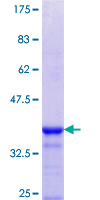 AKAP5 / AKAP79 Protein - 12.5% SDS-PAGE Stained with Coomassie Blue.