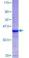 AKAP6 / MAKAP Protein - 12.5% SDS-PAGE Stained with Coomassie Blue.