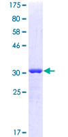 AKAP7 Protein - 12.5% SDS-PAGE of human AKAP7 stained with Coomassie Blue