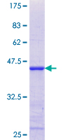 AKAP7 Protein - 12.5% SDS-PAGE Stained with Coomassie Blue.