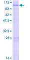 AKAP8 / AKAP95 Protein - 12.5% SDS-PAGE of human AKAP8 stained with Coomassie Blue