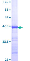 AKAP8 / AKAP95 Protein - 12.5% SDS-PAGE Stained with Coomassie Blue.