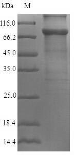 AKAP82 / AKAP4 Protein - (Tris-Glycine gel) Discontinuous SDS-PAGE (reduced) with 5% enrichment gel and 15% separation gel.