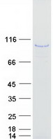 AKAP8L Protein - Purified recombinant protein AKAP8L was analyzed by SDS-PAGE gel and Coomassie Blue Staining