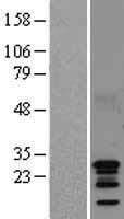 AKIP1 / BCA3 Protein - Western validation with an anti-DDK antibody * L: Control HEK293 lysate R: Over-expression lysate