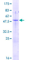 AKIP1 / BCA3 Protein - 12.5% SDS-PAGE of human C11orf17 stained with Coomassie Blue